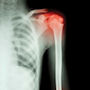 Bone Density Image of a human skeleton